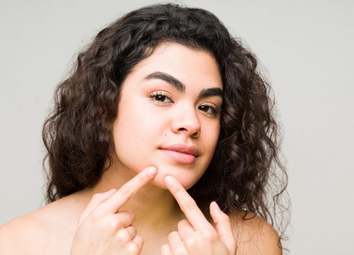 Woman with dark curly hair touching a pimple on her chin